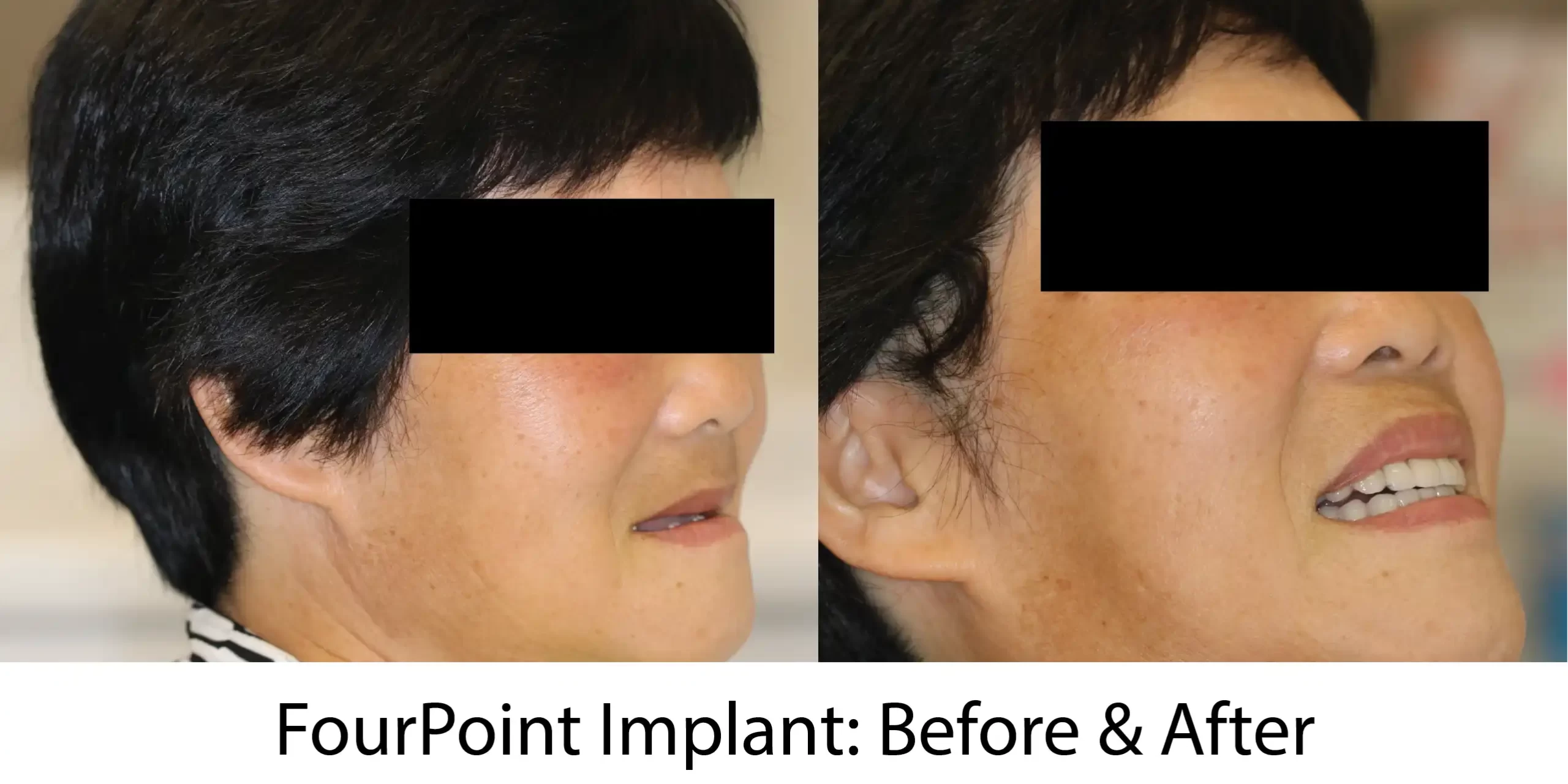 Untitled-1-01_result